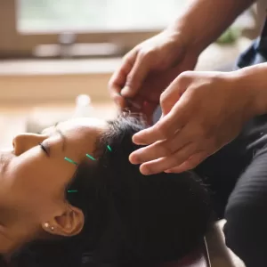 acupuncture treatment